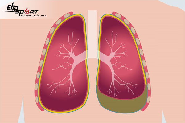 triệu chứng của bệnh phổi