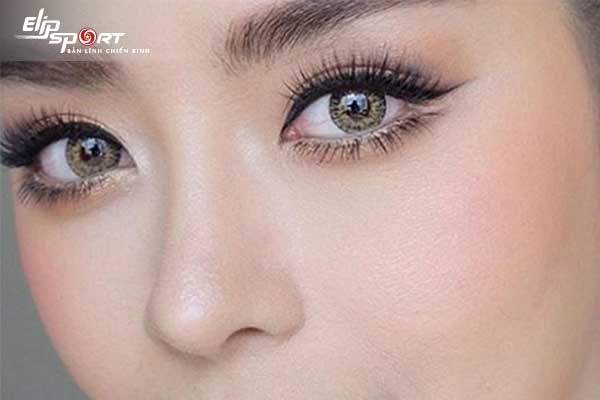 đeo lens cận có mổ mắt được không