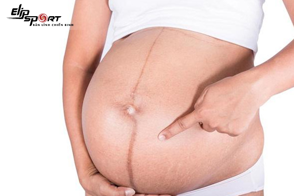 Mọc lông bụng khi mang thai: Đường lông bụng như biểu hiện điều gì?