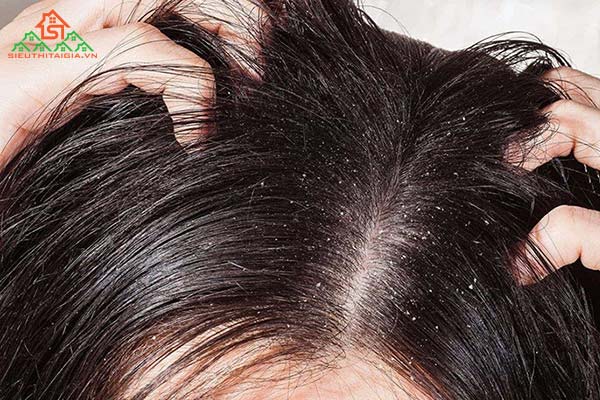 cách làm tóc khô nhanh mà không cần sấy