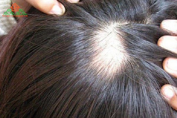 Tổng hợp những tác hại của uốn tóc