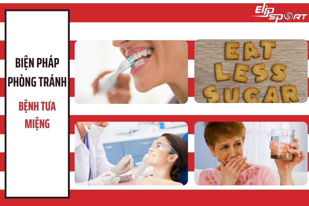 bệnh tưa miệng và phương pháp phòng tránh