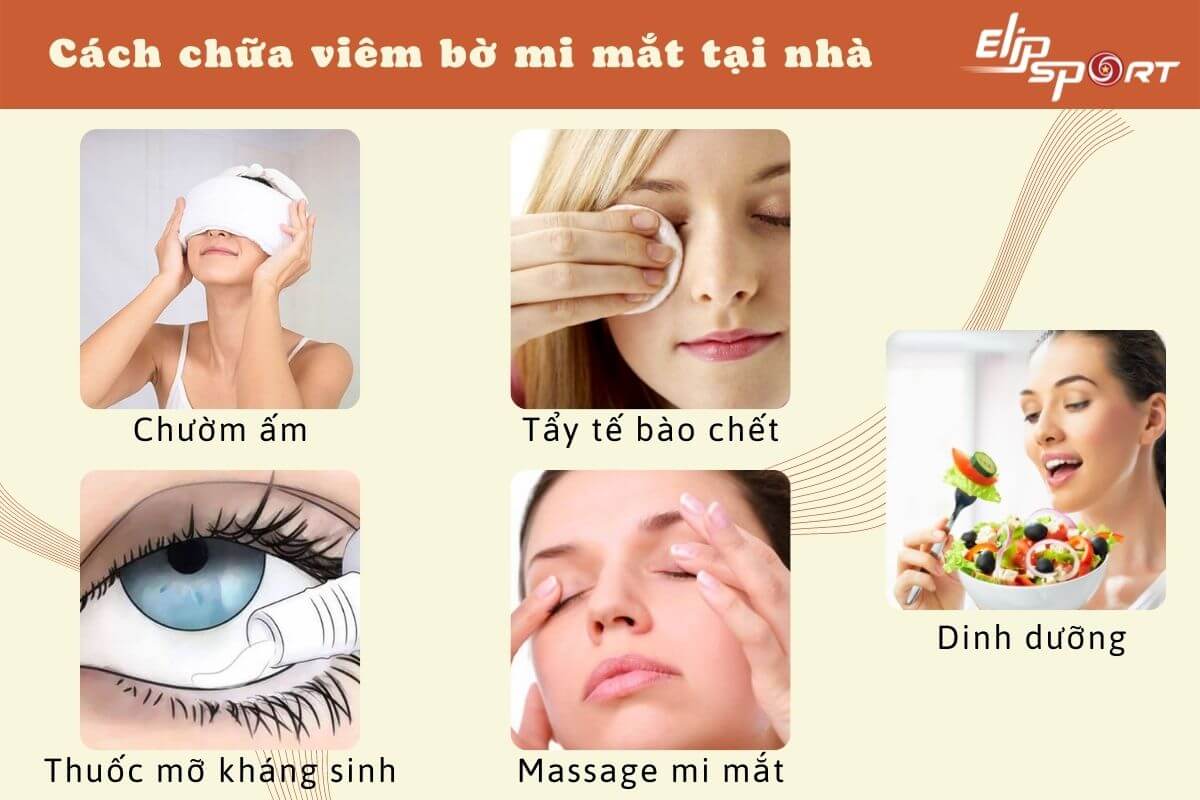 cách chữa viêm bờ mi mắt tại nhà