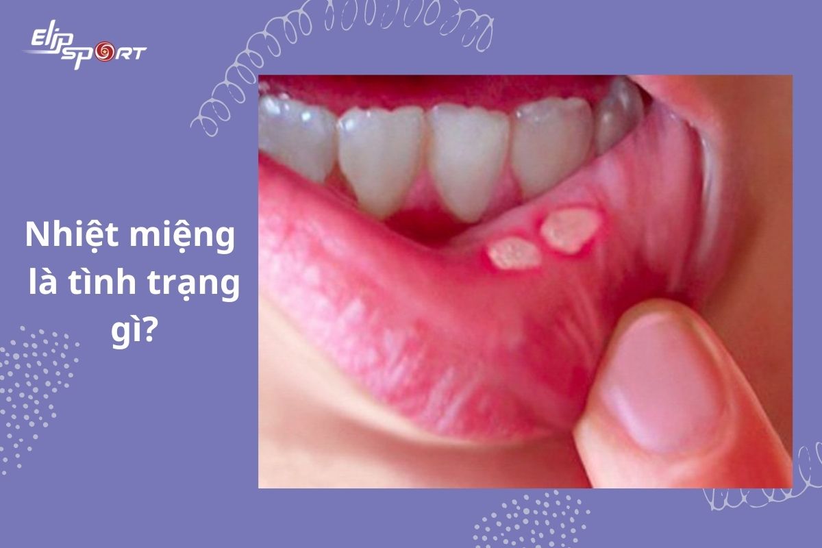nhiệt miệng uống gì