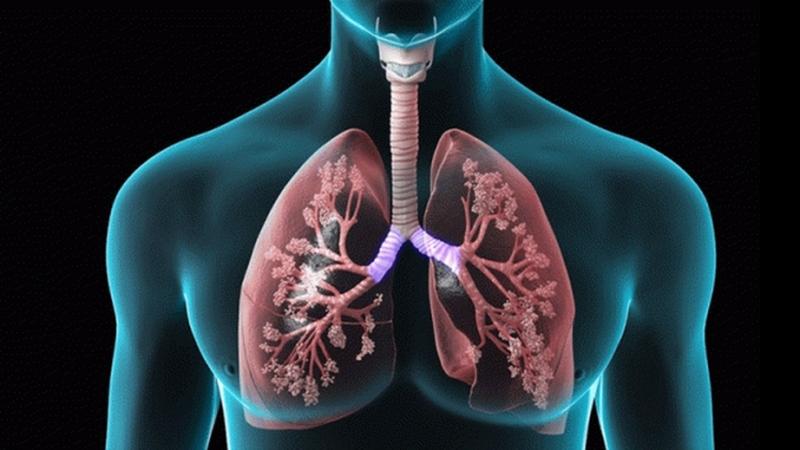 Hỗ trợ kích thích mở rộng phổi và ngực