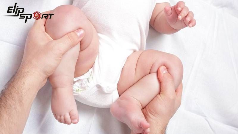 bé bị chân vòng kiềng