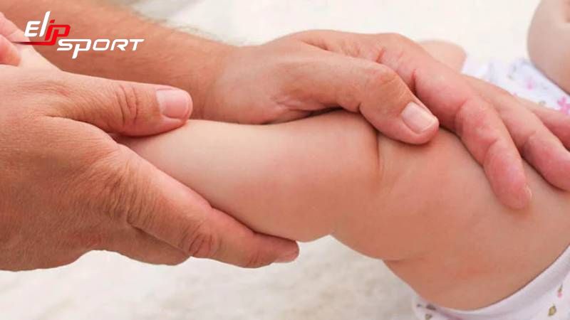 bé bị chân vòng kiềng