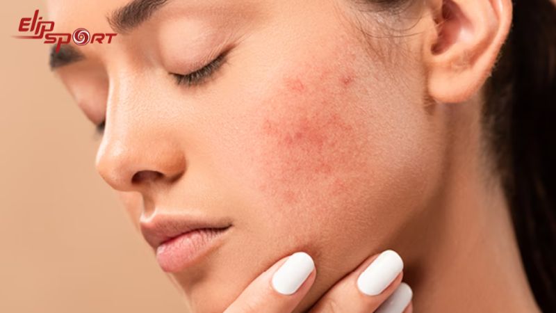 Yến mạch có khả năng điều trị tình trạng da khô và kích ứng