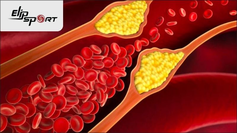 Giảm cholesterol