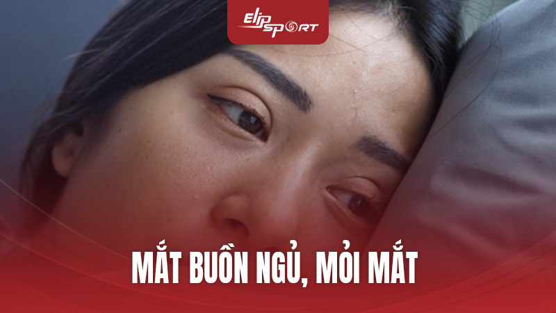 Mắt Buồn Ngủ, Mỏi Mắt: Nguyên Nhân Và Cách Khắc Phục Hiệu Quả Từ ElipSport